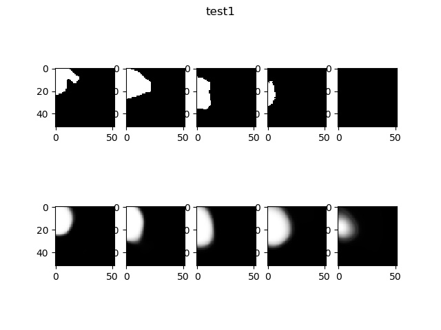 diag of unet